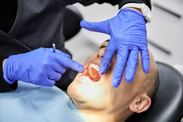 Best Knocked-Out Tooth Emergency  in Albany, MO